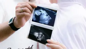 Potret Irish Bella Bagikan Maternity Shoot Bareng Haldy Sabri, Tunjukkan Hasil USG