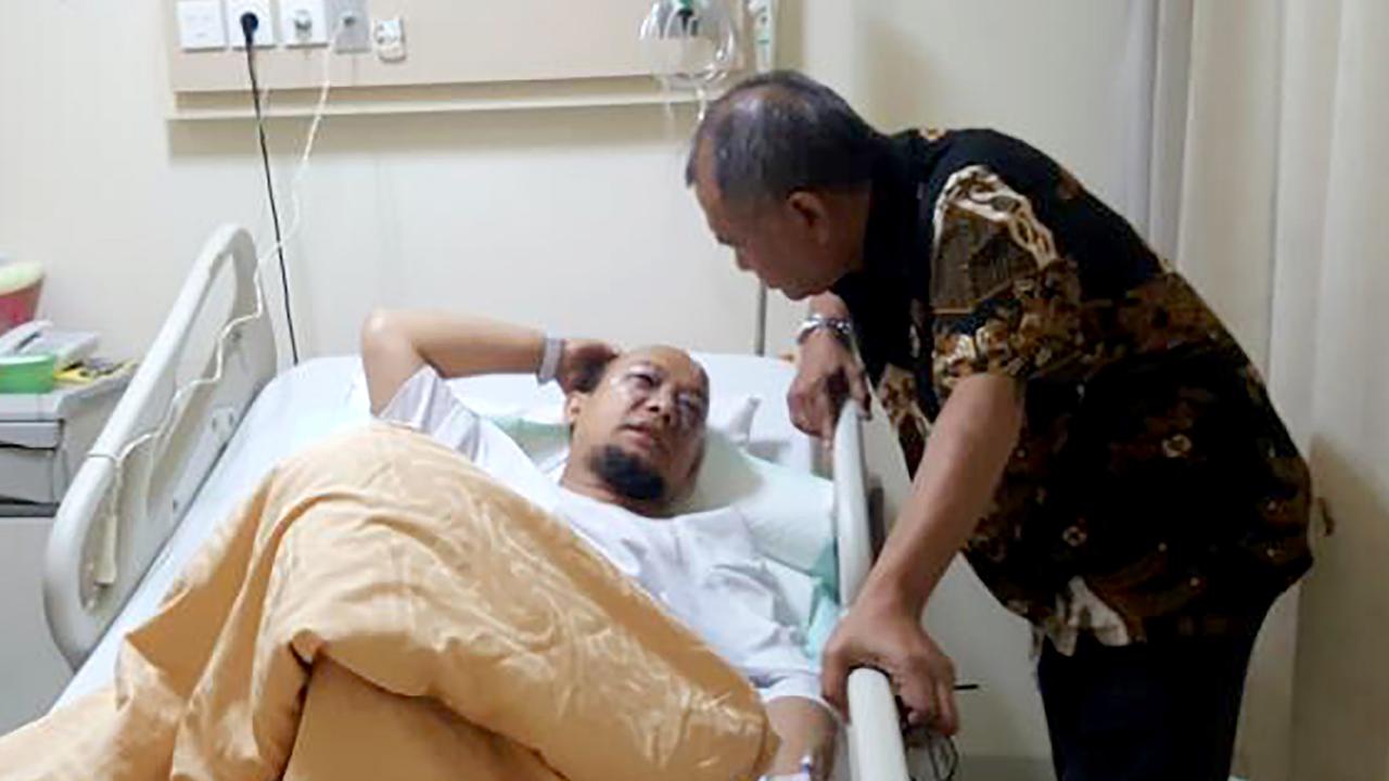 Kondisi Novel Baswedan Saat Dijenguk Ketua KPK dan Kapolda Metro Jaya- AFP Photo-spripimpoldametro-20170411