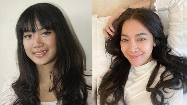 Potret Penyanyi Cantik Sebelum dan Sesudah Tanam Benang
