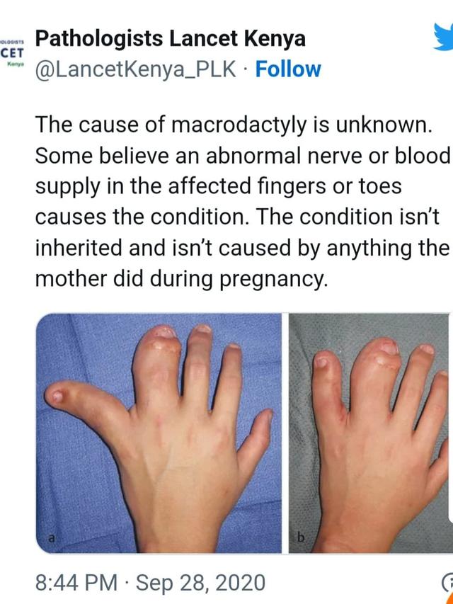 Tangan Berukuran Raksasa