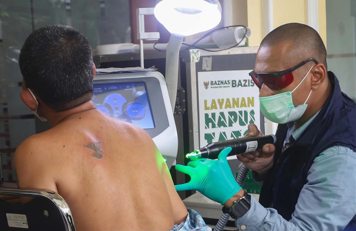 FOTO: Layanan Hapus Tato Gratis Sambut Ramadhan di Jakarta