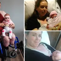 Ella Clarke siuman usai melahirkan anaknya yang ke-8, dengan kedua kakinya yang telah diamputasi. 