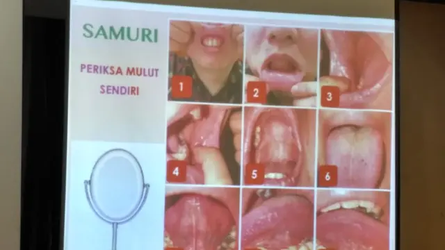 SAMURI: Periksa Mulut Sendiri (Foto: Benedikta Desideria)