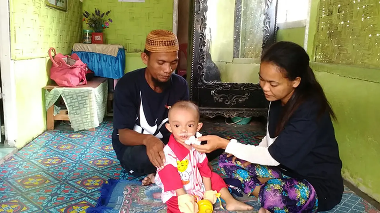 YPAPK dan FKG UI Lakukan Operasi Celah Bibir di Gorontalo