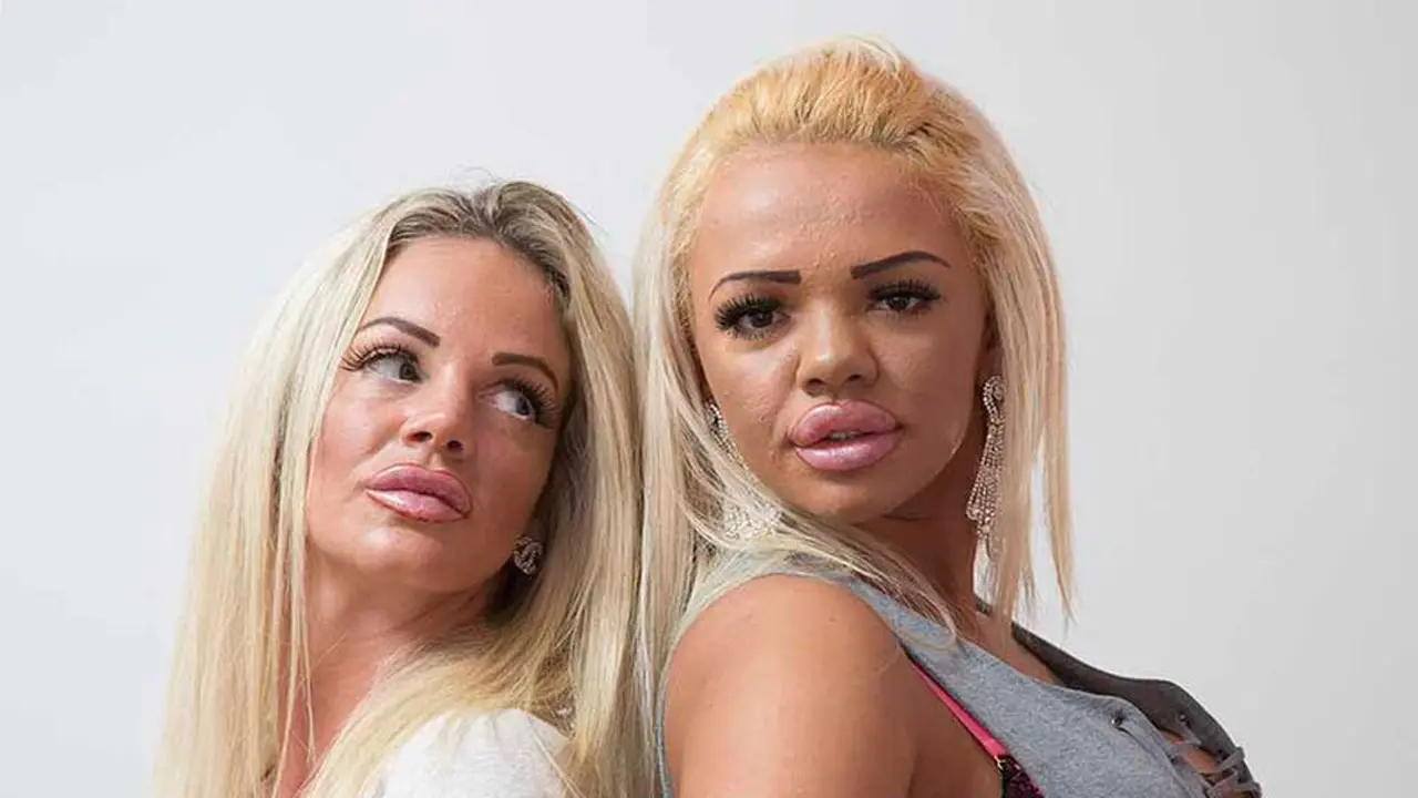 Demi Mirip Model, Ibu dan Anak Ini Kompak Operasi Plastik