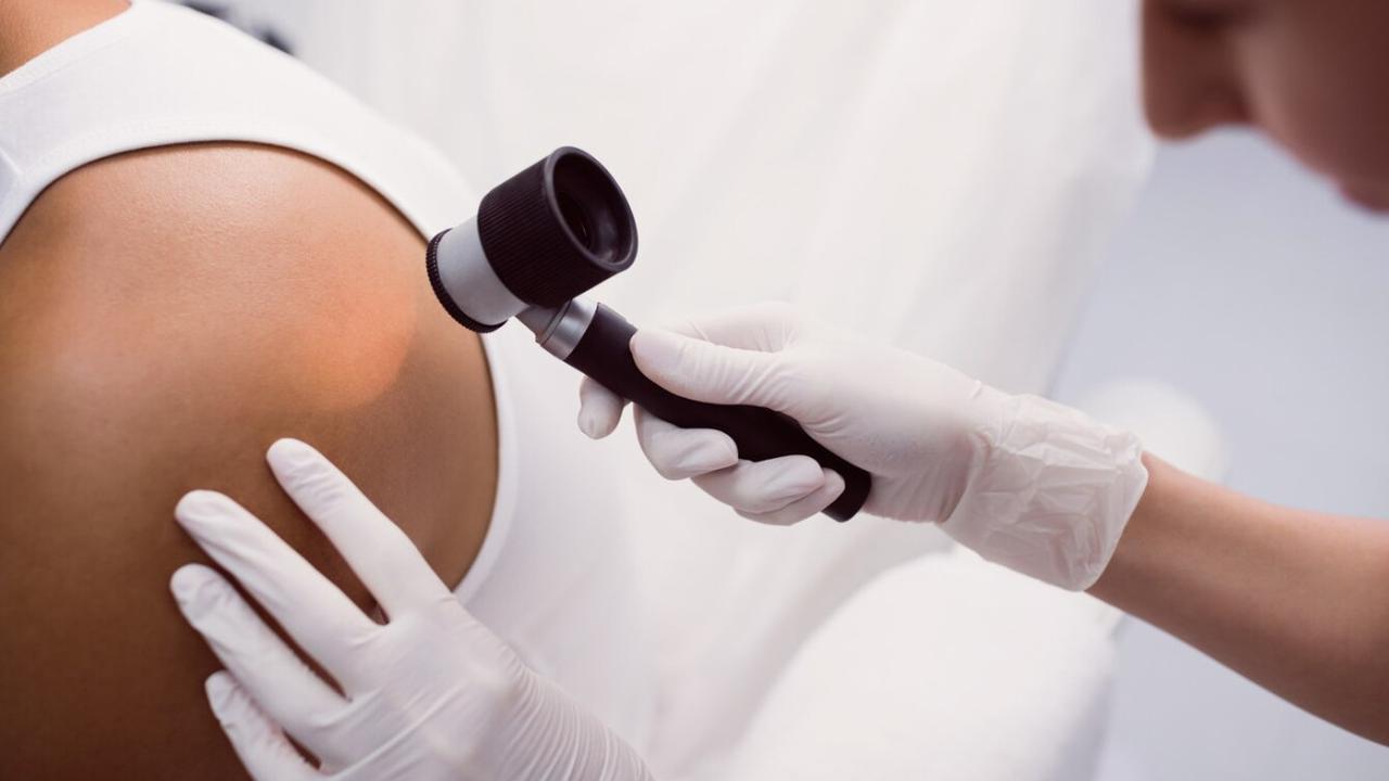 Steven Johnson Syndrome: Panduan untuk Pasien dan Keluarga dalam Proses Diagnosa