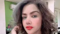 Barbie Kumalasari Kena Jambret, Alami Luka-Luka dan Kerugian Rp 400 Juta