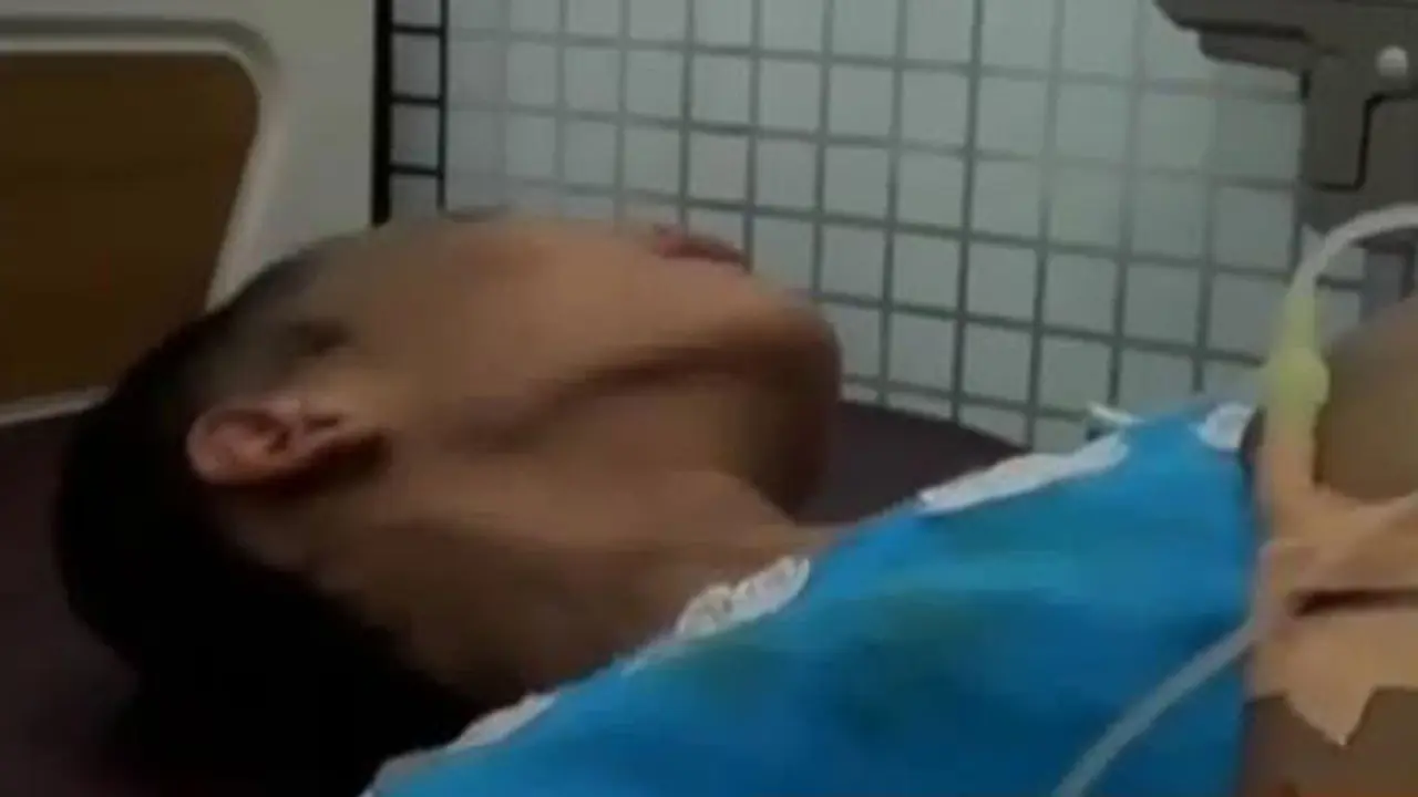 Anak Korban Penganiayaan Ibu Kandung