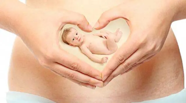 Sonya Fatmala istri Hengky Kurniawan dalam tahap pemulihan usai operasi kista, akui badan mudah lelah