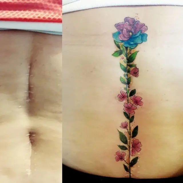 tato dari bekas luka (foto: boredpanda)