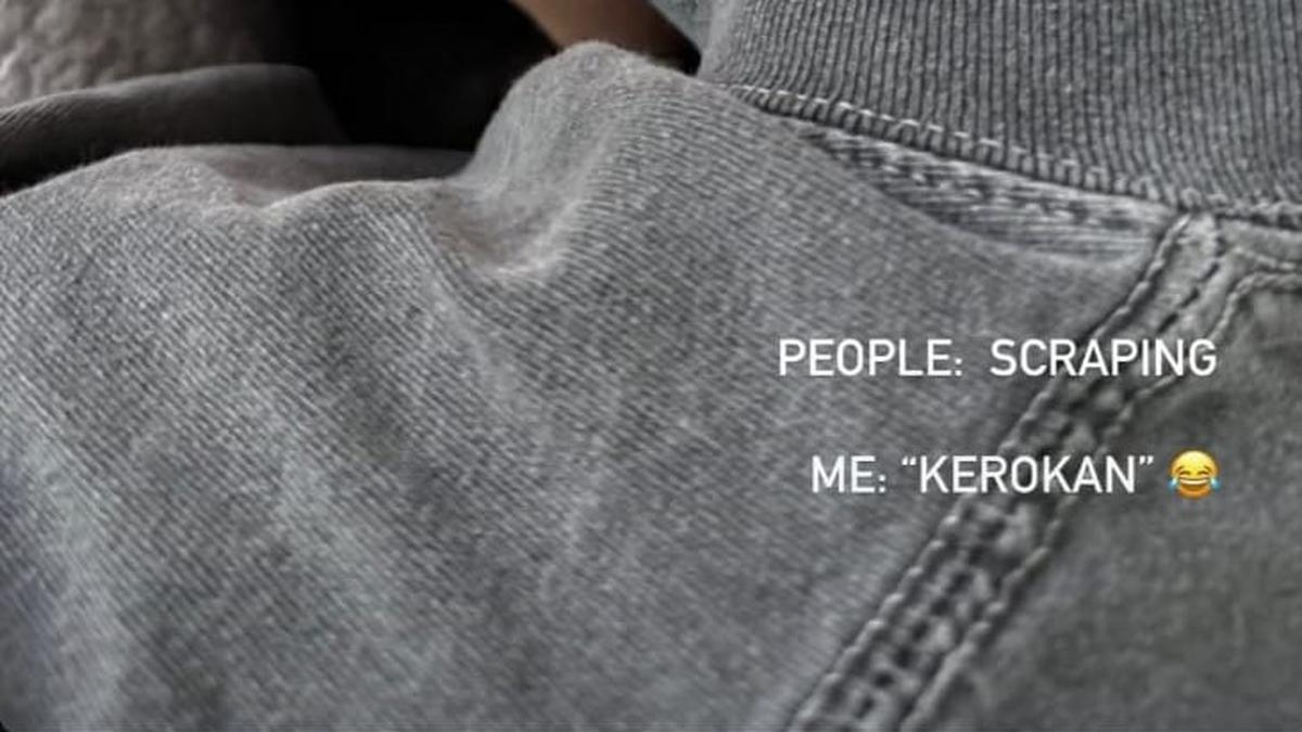 Agnez Mo Sempat Bikin Heboh Usai Unggah Foto Leher Memerah, Ketahui Manfaat dan Risiko dari Kerokan