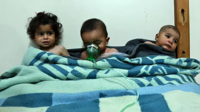 FOTO: Derita Anak-Anak Suriah Korban Senjata Kimia Assad