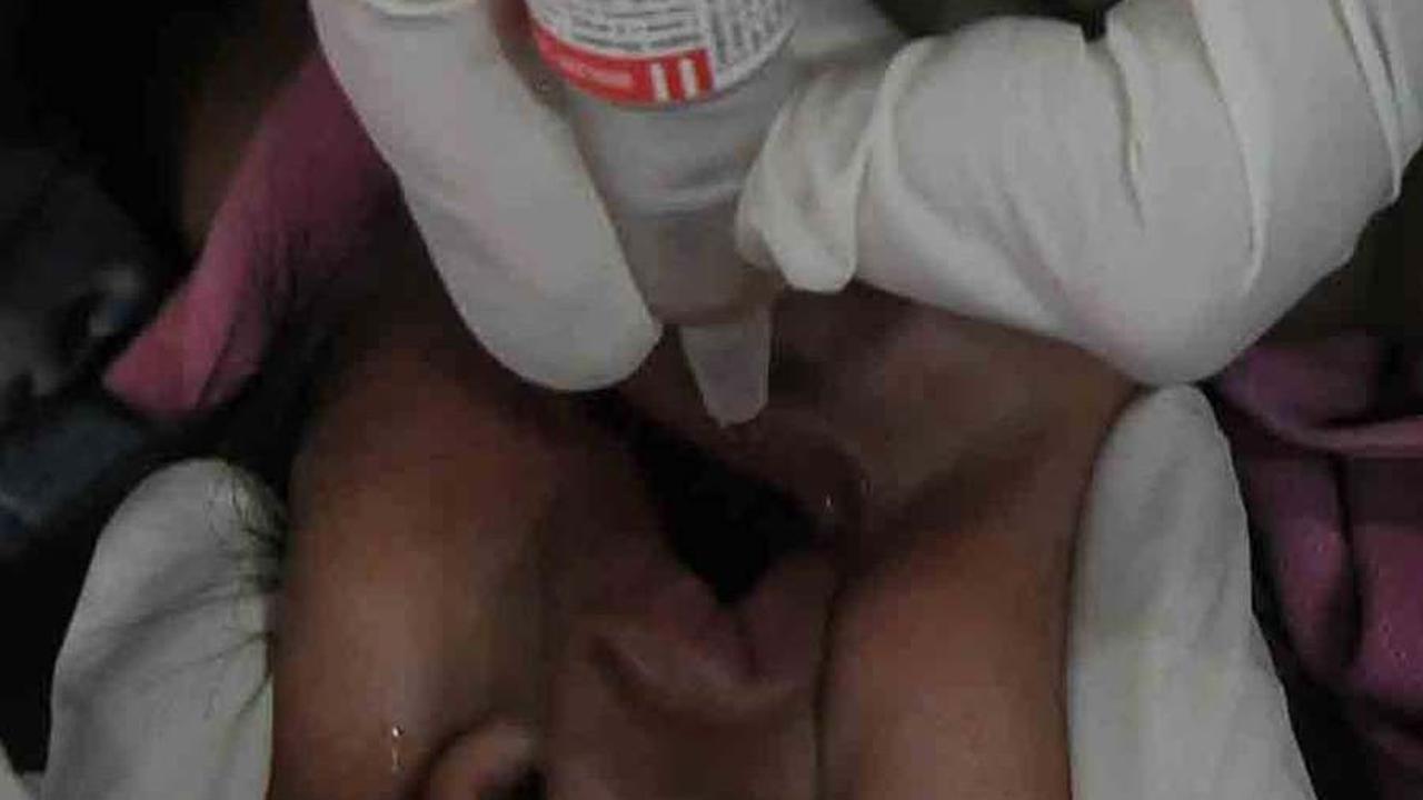 FOTO: Cegah Diare Berat, Kemenkes Gelar Imunisasi Rotavirus Secara Nasional