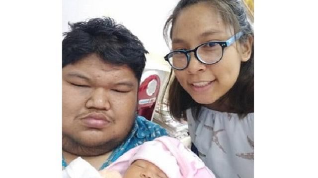 Sempat Diejek karena Tubuhnya, Pria ini Justru Temukan Cinta Sejati