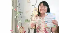 Diprediksi Takkan Hidup Lama, Down Syndrome Asal Bandung Berhasil Injak Usia 10 dengan Berbagai Prestasi