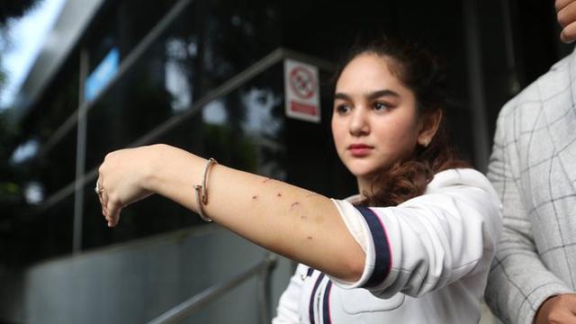Hana Hanifah Jual Tas Mewahnya Seharga Rp 49 Juta Showbiz Liputan6 Com
