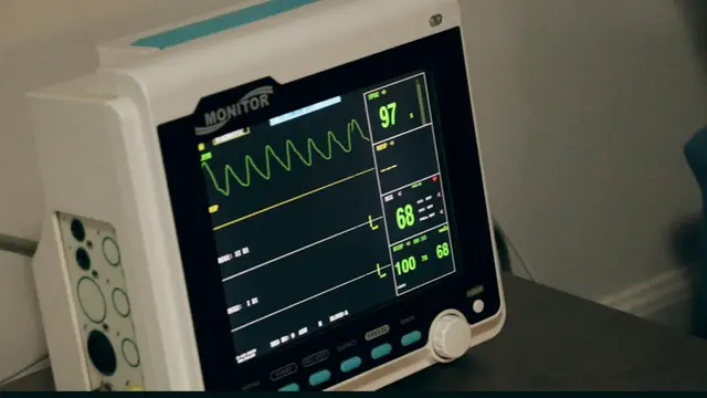 EKG