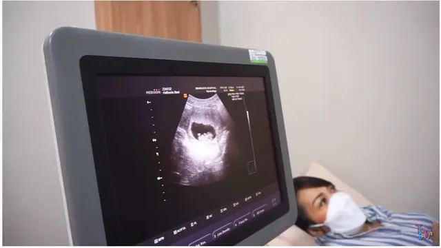 Momen Haru Nola B3 Umumkan Kehamilan Anak Keempat, Penuh Suka Cita. (Sumber: YouTube/The Baldys)