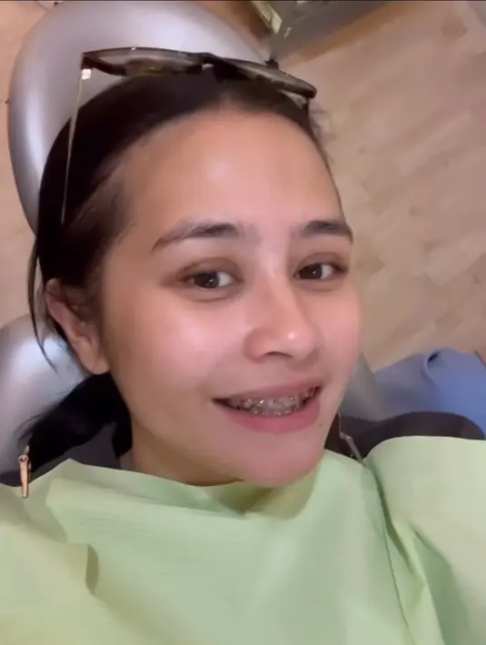 Sebelumnya, Prilly sampai konsul ke dokter gigi sebelum melakukan tindakan ini, agar tidak merusak giginya yang sudah rapi. Momen Prilly pertama kali mengenakan behel ini terkesan aneh. (Liputan6.com/IG/@prillylatuconsina96).