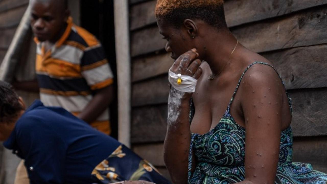Wabah Mpox atau Cacar Monyet di Burundi