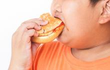Gemuk Bukan Tanda Sehat, Begini Cara Atasi Obesitas pada Anak