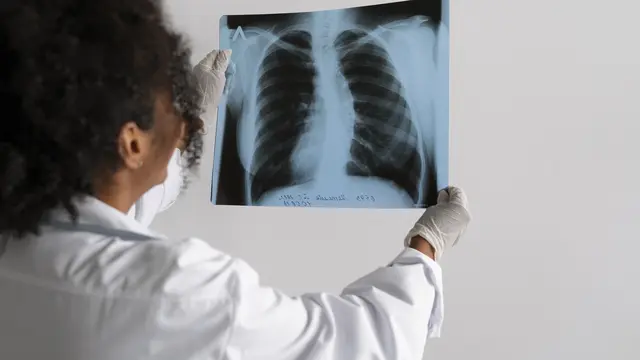 Seorang dokter sedang melihat hasil rontgen paru-paru (Foto Dok: Freepik/freepik)