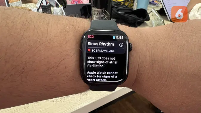 <p>Apple Watch. (Liputan6.com/ Yuslianson)</p>