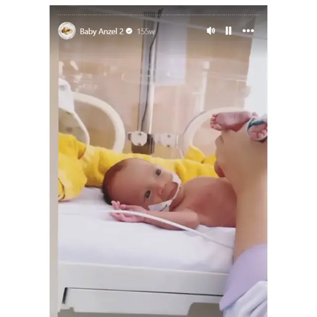6 Potret Kondisi Anzel Anak Audi Marissa ketika Lahir Prematur, Kini Genap 3 Tahun