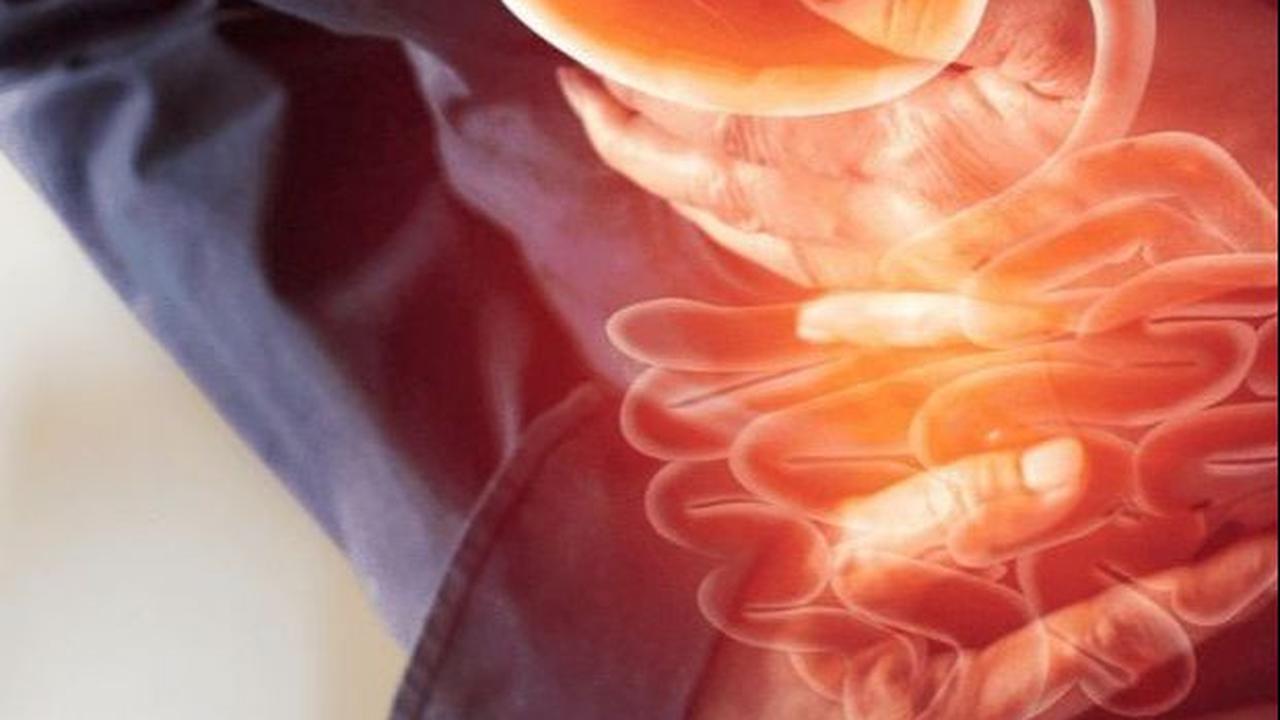 Cara Mengatasi Gastroparesis