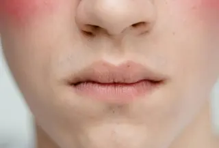 Selama berpuasa tubuh cenderung mengalami penurunan asupan cairan yang dapat berdampak pada kondisi kulit (Sumber: Pexels.com)