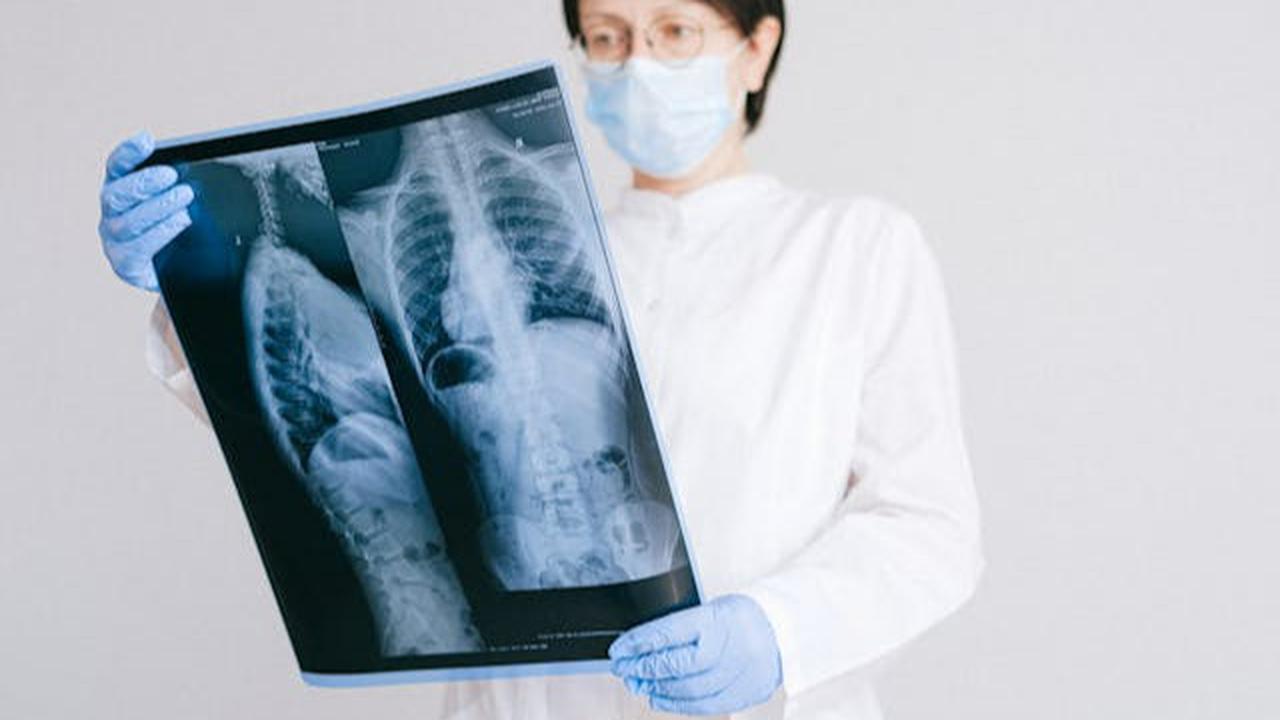 CT Scan atau MRI? Kenali Perbedaan dan Kapan Harus Digunakan