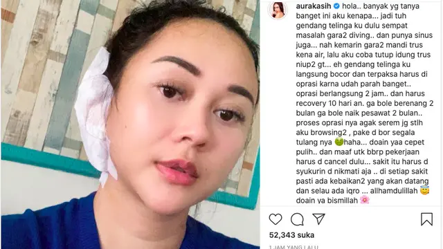 Aura Kasih Jalani Operasi Karena Gendang Telinganya Bocor