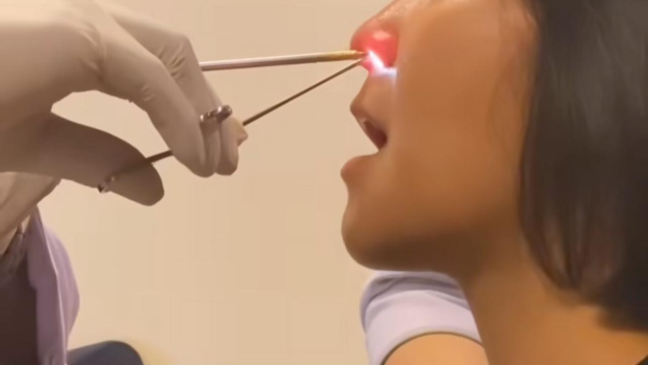 Caca Tengker Tiap Bulan Masuk Rumah Sakit, Idap Covid, Sinusitis Hingga Operasi Kantung Empedu