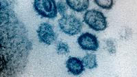 Gambar tak bertanggal menggunakan mikroskop elektron pada Februari 2020 menunjukkan virus corona SARS-CoV-2, diambil dari seorang pasien yang terinfeksi COVID-19. Setelah sebelumnya dikenal sebagai 2019-nCoV, virus ini merupakan penyebab dari apa yang disebut penyakit COVID-19. (NIAID-RML via AP)