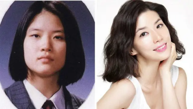 Artis Korea Operasi Plastik