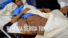 Seorang remaja di Pakistan terbaring di tempat tidur karena tumor seberat 20 kilogram di kakinya. 