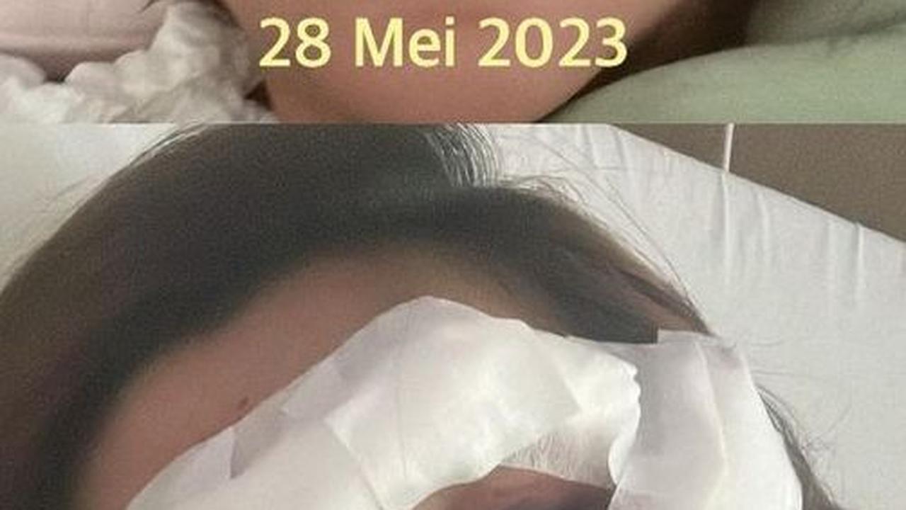 Dari hari ke hari, kondisi Angela Lee terus berangsur membaik. Angela Lee memperlihatkan potret dirinya dua hari setelah kecelakaan. Selang dua hari saja, Angela sudah terlihat membaik. Meski masih ada perban di wajahnya.