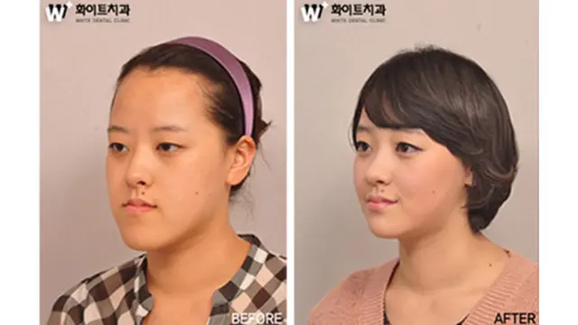 (c) kpsurgery tumblr.com