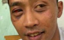 Tragis dan Memilukan, Pengamen Keterbelakangan Mental Dipukuli  dan Uangnya Dirampas Orang Tak Dikenal