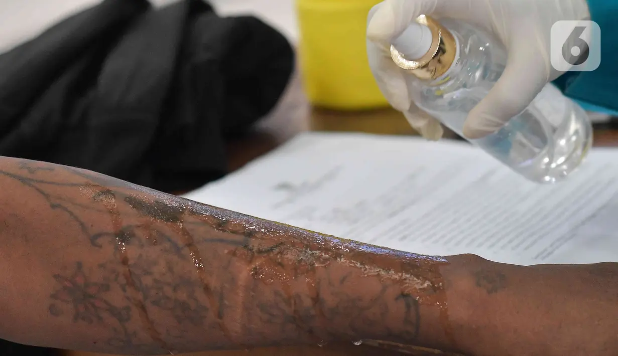 Dalam kegiatan itu, sebanyak 123 orang yang ingin menghapus tato. (Liputan6.com/Herman Zakharia)