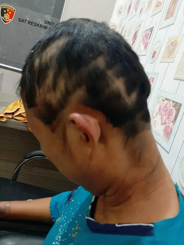 Sadis, Pria di Banyuasin Masukkan Batu Cobek ke Alat Vital Istri Sirinya