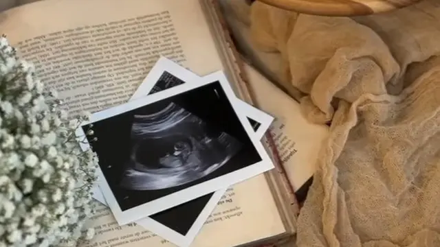 Mahalini dan Aaliyah Massaid Bagikan Momen Hamil. (instagram/aaliyah.massaid/thariqhalilintar)