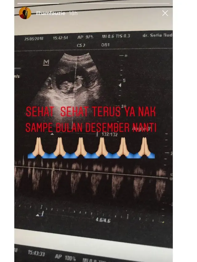 Ilham SMASH