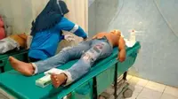 2 Wisatawan Pulau Merah Banyuwangi Dikeroyok Orang Tak Dikenal, Ponsel dan Uang Dirampas