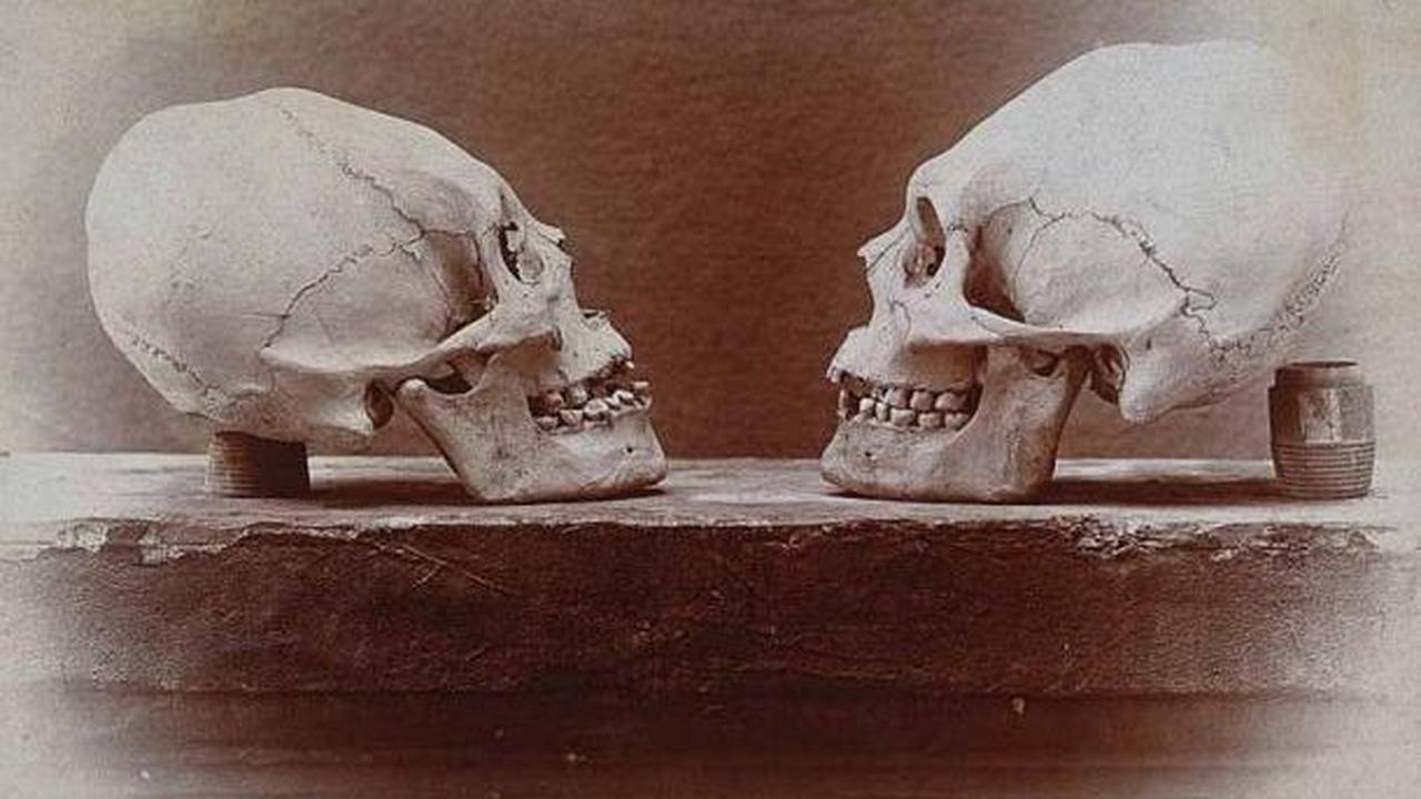 Meskipun tujuan pasti modifikasi tengkorak ini masih belum sepenuhnya dipahami, para peneliti memberikan hipotesis yang menarik. Mereka mengaitkan praktek ini dengan identitas kelompok suku Hirota dan kemungkinan adanya jaringan perdagangan jarak jauh.