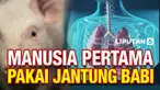 Ahli bedah di University of Maryland terus memantau pasien cangkok jantung babi yang awal Januari menjadi manusia pertama yang mendapat transplantasi jantung lintas-spesies dari babi. Teknologi yang juga disebut "xeno-transplantasi" ini diharap bisa ...