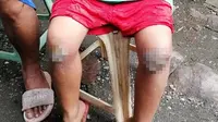 Luka pada lutut bocah 8 tahun yang dihukum oleh ibunya (Sumber: Leah Agonoy/Inquirer Mindanao)