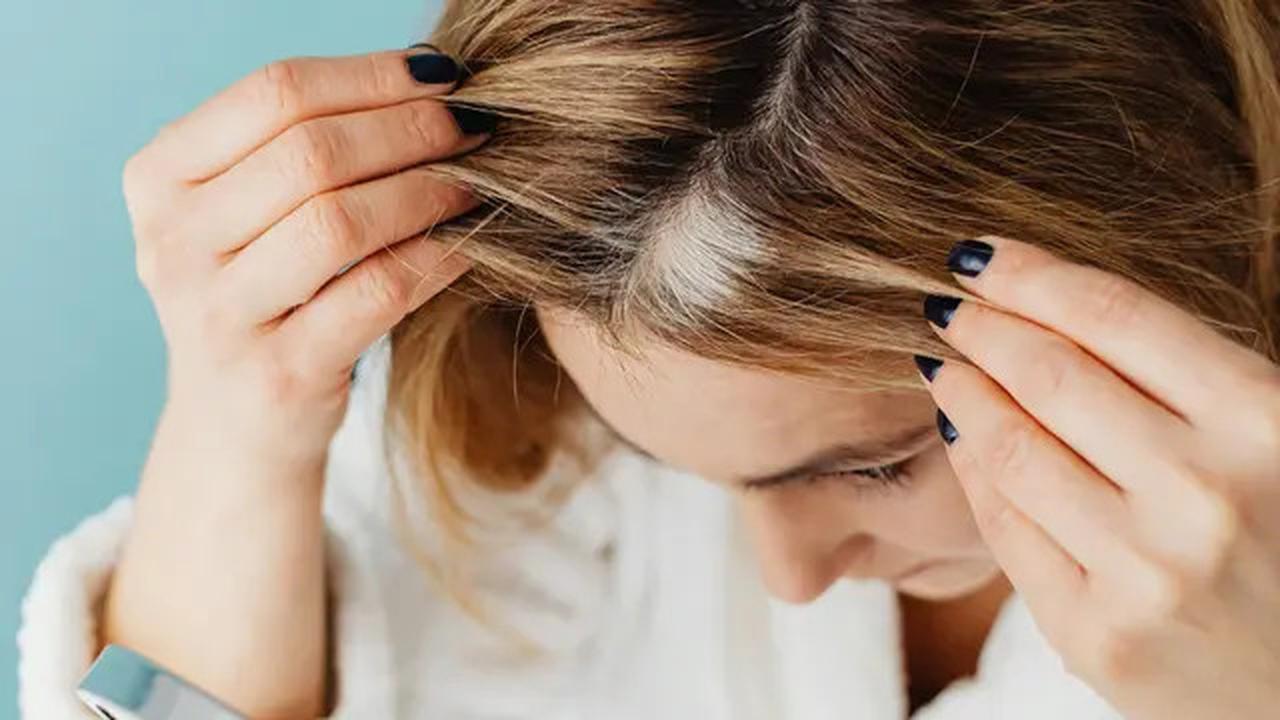 Cara Mengatasi Rambut Pitak  dengan Trik Makeup yang Mudah dan Praktis