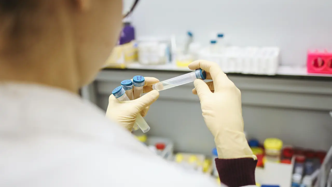 Mengenal Virus Marburg Mirip Ebola yang Sebabkan Kematian di Afrika Barat