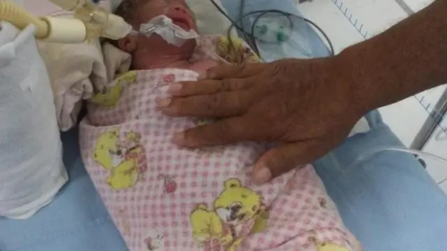 [Bintang] Viral Wanita di Medan Meninggal karena Krim Pemutih Wajah, Ternyata Begini Cerita Sebenarnya